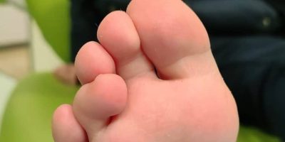 dedos-montados-niños